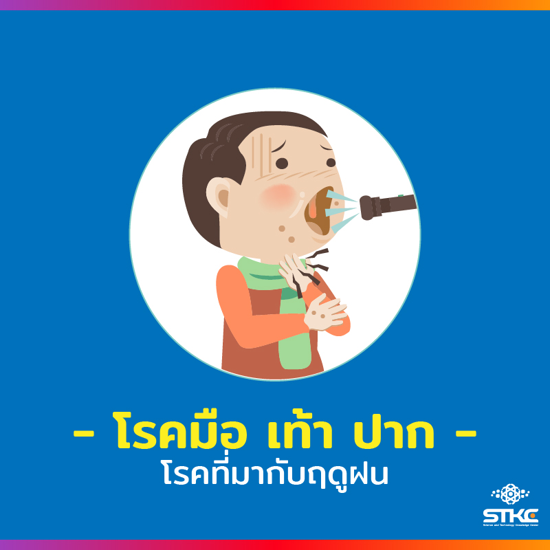 [โรคที่มากับหน้าฝน] โรคมือ เท้า ปาก