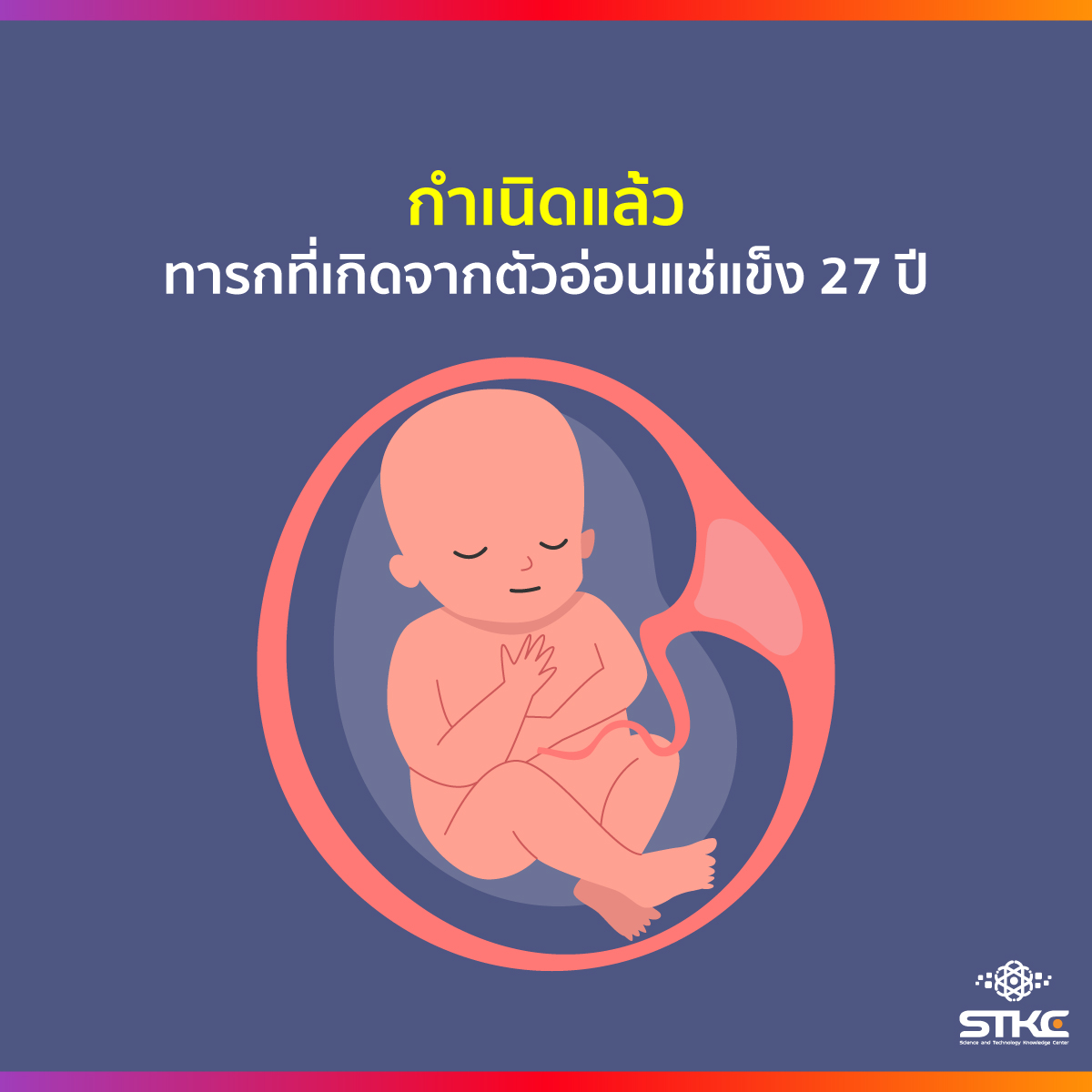 กำเนิดแล้ว...ทารกที่เกิดจากตัวอ่อนแช่แข็ง 27 ปี