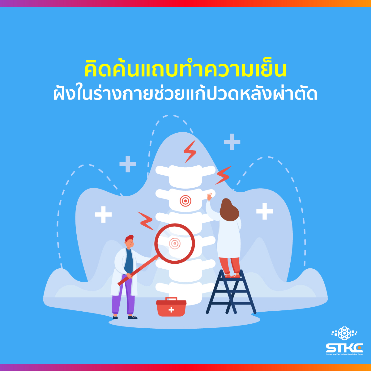 คิดค้นแถบทำความเย็น ฝังในร่างกายช่วยแก้ปวดหลังผ่าตัด