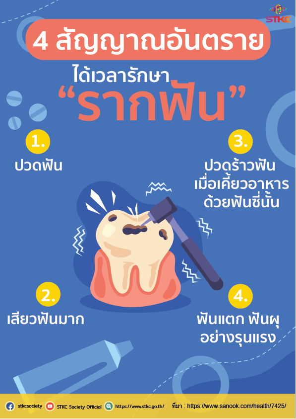 4 สัญญาณอันตราย ได้เวลารักษารากฟัน