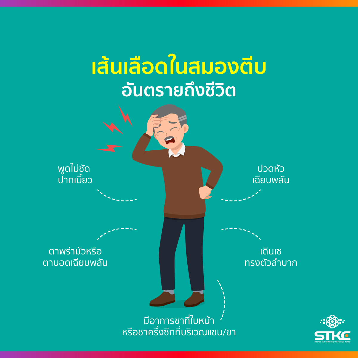 เส้นเลือดในสมองตีบ อันตรายถึงชีวิต
