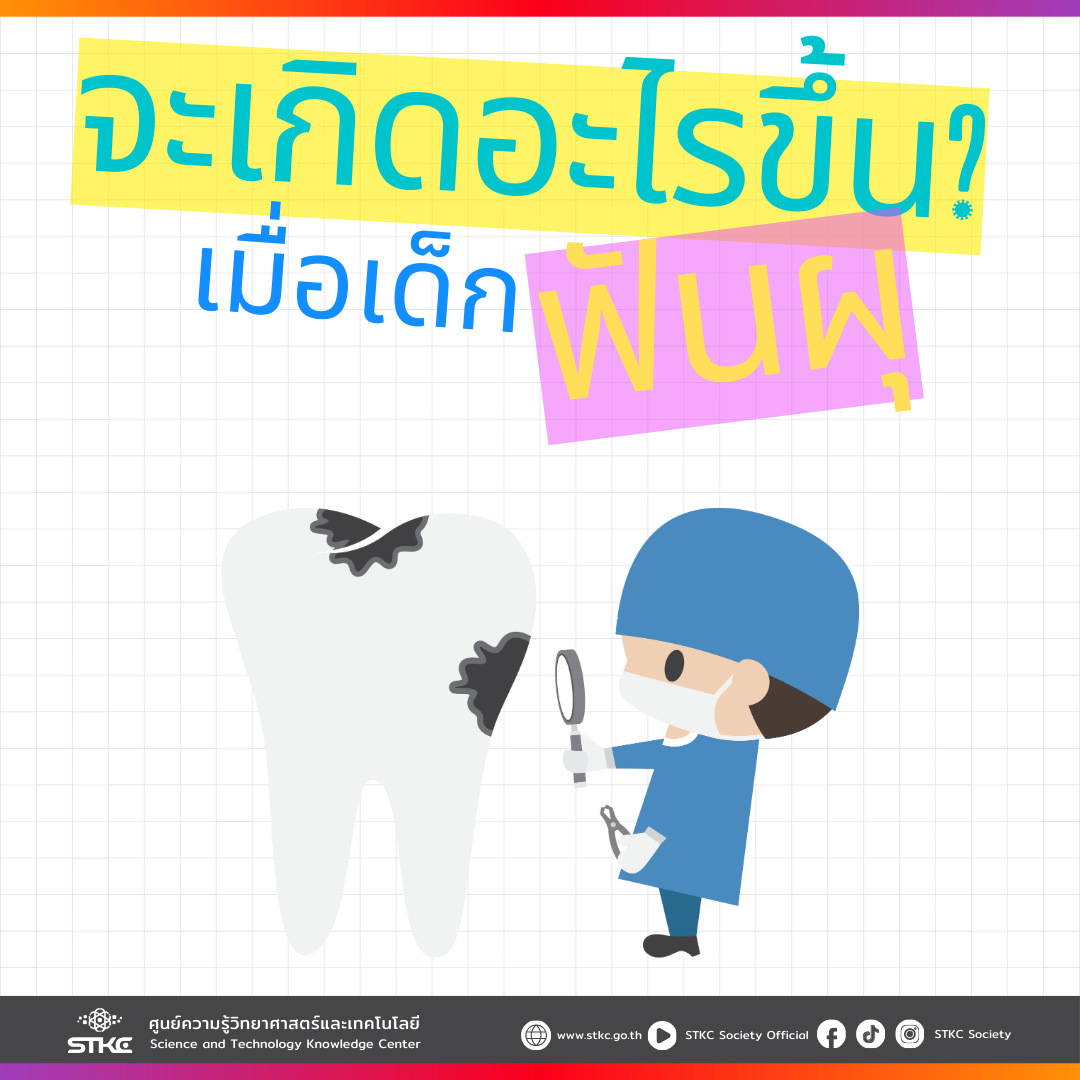 จะเกิดอะไรขึ้นเมื่อเด็กฟันผุ